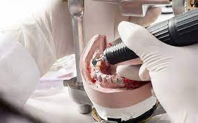 The Art and Science of Dental Lab Technology: A Comprehensive Overview post thumbnail image
